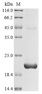 T cell receptor beta constant 1 (TRBC1), partial, human, recombinant