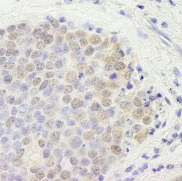 Anti-p66beta/GATAD2B (IHC)