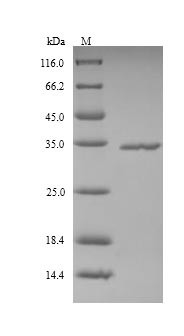 Ficolin-2 (FCN2), human, recombinant