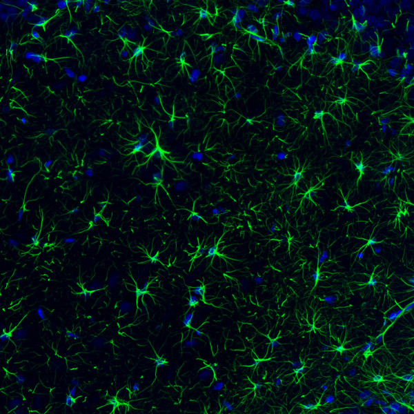 Anti-GFAP, clone CL2713