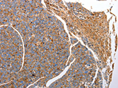 Anti-CD151