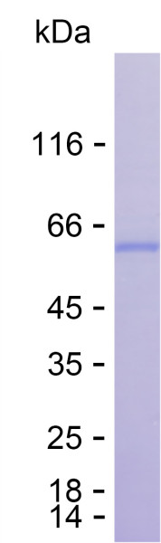 Recombinant Human RIT1 Protein