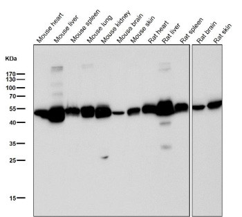 Anti-ALDH2 / Aldehyde dehydrogenase 2, clone 31A72