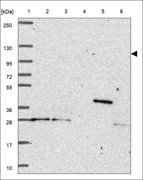 Anti-TCIRG1