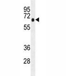 Anti-AMPK alpha 1 / PRKAA1, clone 167CT22.1.6