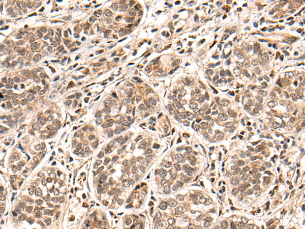 Anti-HGH1