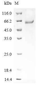Latent-transforming growth factor beta-binding protein 4 (Ltbp4), partial, mouse, recombinant