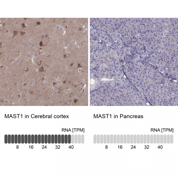 Anti-MAST1
