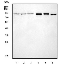 Anti-FES / Tyrosine-protein kinase Fes/Fps