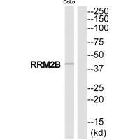 Anti-RRM2B