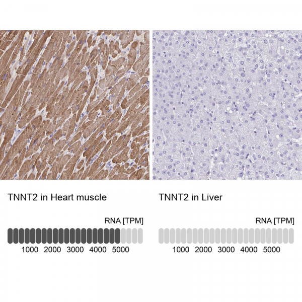 Anti-TNNT2