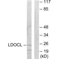 Anti-LDOC1L