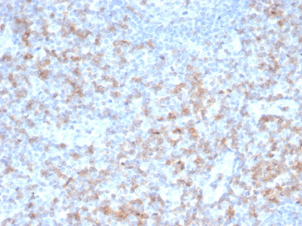 Anti-CD5 (Mantle Cell Lymphoma Marker), recombinant antibody, clone rC5/6462