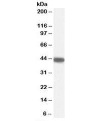 Anti-SERPINB9