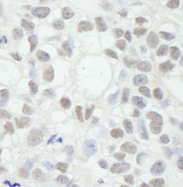 Anti-MED12 (IHC)