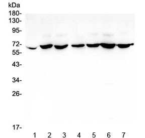 Anti-CD1b