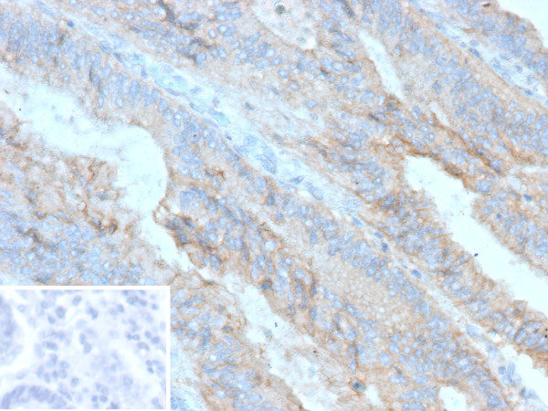 Anti-P-Cadherin (CDH3) (Basal Epithelial Cell Marker), recombinant antibody, clone r56C1