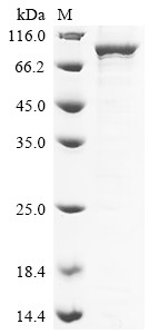 Putative ATP-dependent RNA helicase DHX33 (DHX33), human, recombinant