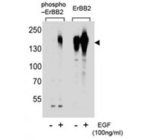 Anti-phospho-HER2 (Ser1107)
