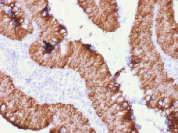 Anti-Ep-CAM / CD326 (Extracellular Domain) (Epithelial Marker) Recombinant Mouse Monoclonal Antibody