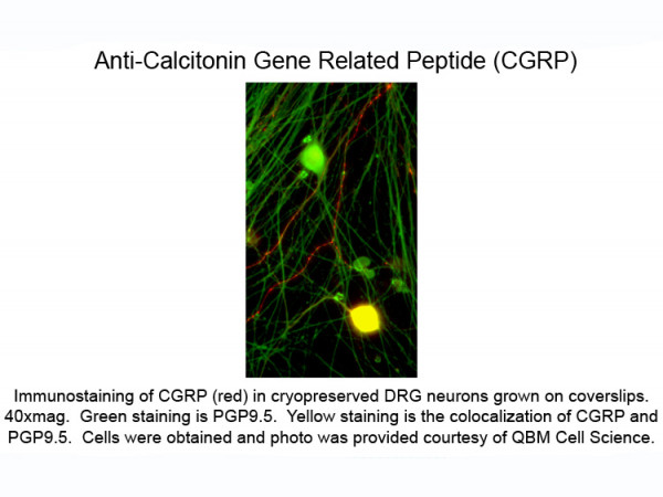Anti-Calcitonin Gene Related Peptide (CGRP), clone 4901