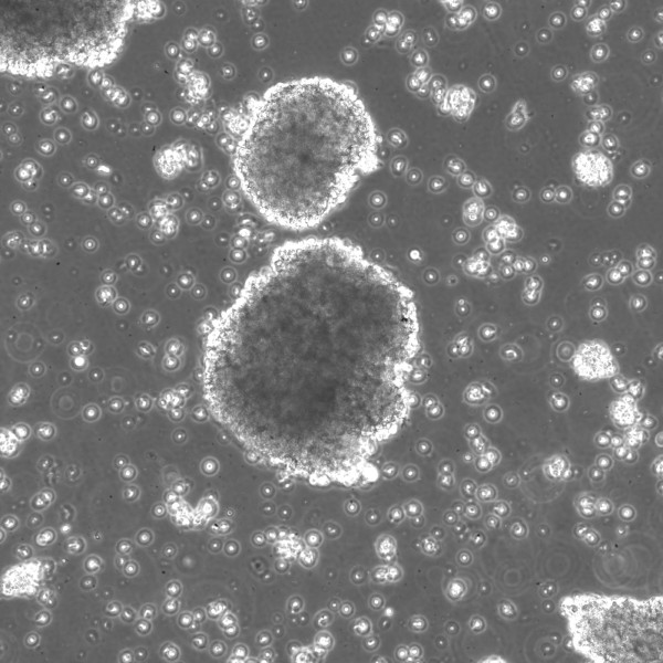 B-LCL-CDG4 Cells