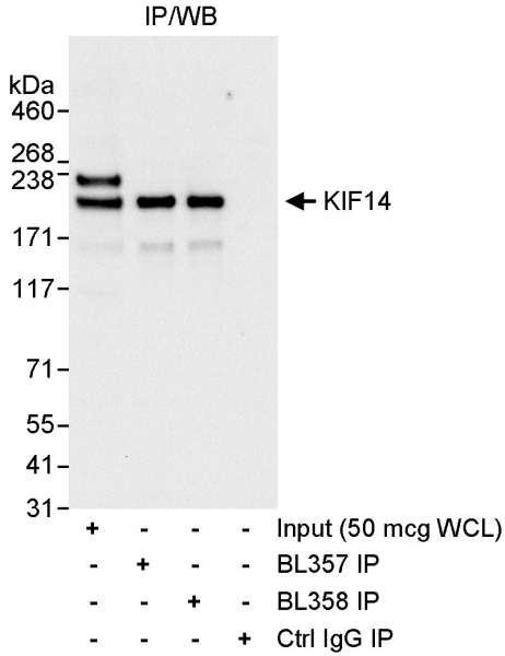 Anti-KIF14