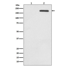 Anti-phospho-EGF Receptor / EGFR (Tyr1068), clone HOF-5