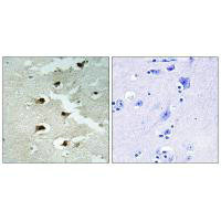 Anti-CDCA4