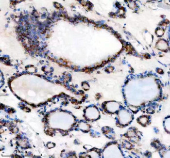 Anti-TMED10 / Transmembrane p24 trafficking protein 10