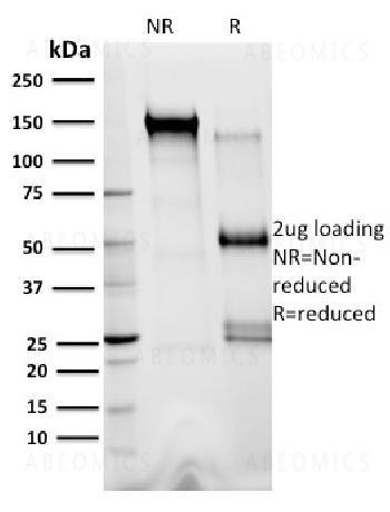 Anti-XRCC3 Monoclonal Antibody (Clone: 10F1/6)