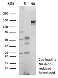 Anti-IGHG1 / Immunoglobulin heavy constant gamma 1, clone rIGHG1/13035