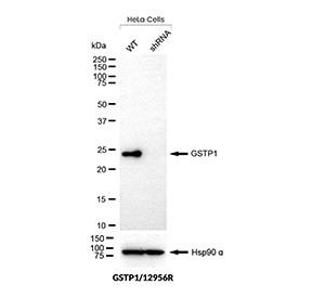 Anti-GST pi / Glutathione S-transferase pi 1, clone GSTP1/12956R