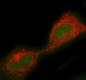 Anti-PCBD1 / Pterin-4 alpha-carbinolamine dehydratase