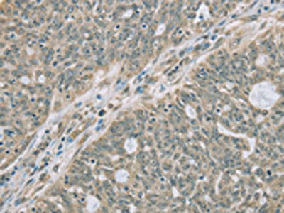 Anti-RNASE3