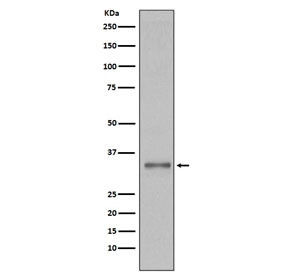 Anti-Torsin A / TOR1A, clone BAH-20