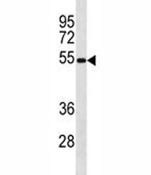 Anti-Ips-1