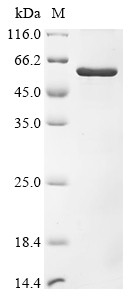 Plexin domain-containing protein 2 (PLXDC2), partial, human, recombinant