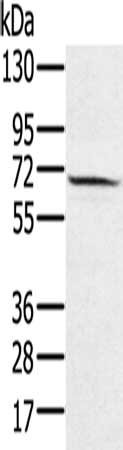 Anti-HSF2
