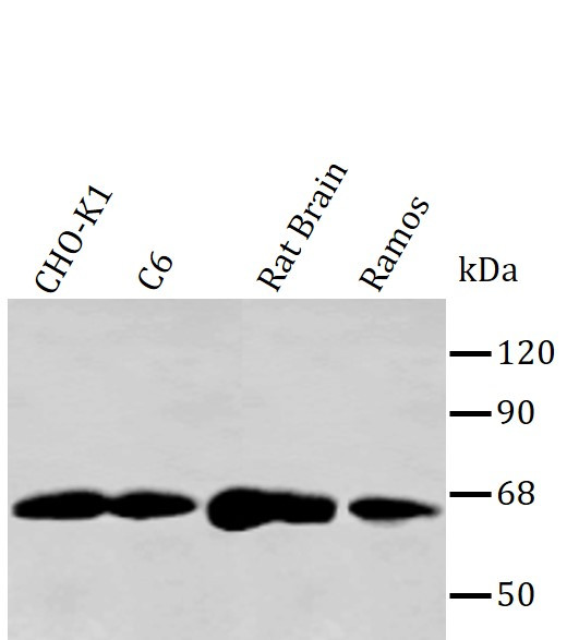 Anti-Pyruvate Dehydrogenase E2