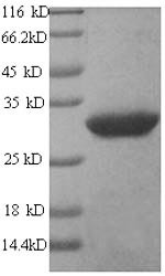 GPI-linked NAD (P) (+)--arginine ADP-ribosyltransferase 1 (ART1), human, recombinant