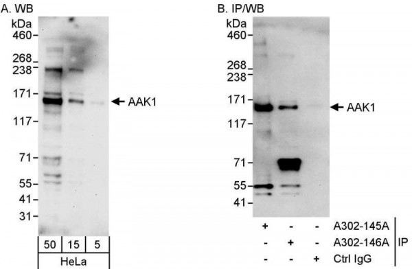 Anti-AAK1