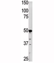 Anti-PGK2