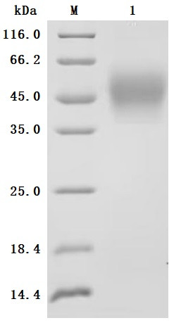 Interleukin-4 receptor subunit alpha (IL4R), partial, Biotinylated (Active), human, recombinant