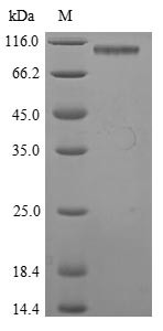 Pancreatic secretory granule membrane major glycoprotein GP2 (Gp2), mouse, recombinant
