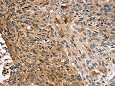 Anti-CNGA1