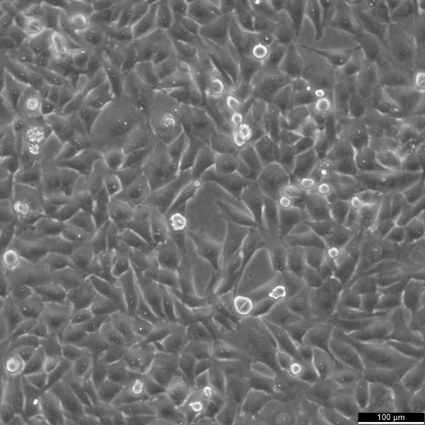 KMH-2 Cells