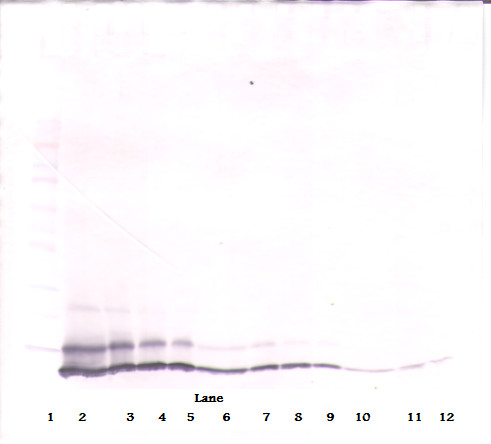 Anti-Cxcl1