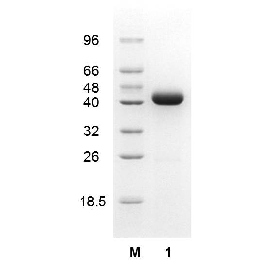 Aspartate aminotransferase (EC 2.6.1.1), Escherichia coli