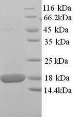 Superoxide dismutase [Cu-Zn] (Sod1), mouse, recombinant